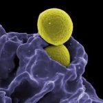HORMONE / IMMUNOLOGY TEST